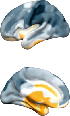 Verteilung der Signalkomplexität am Beispiel der linken Hirnhälfte in der Ansicht von außen (oben) und innen (unten).